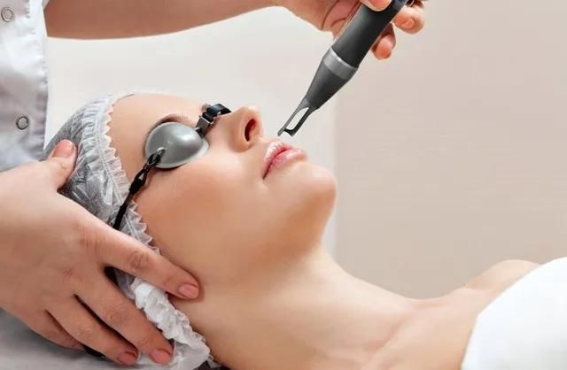 Pico Laser untuk Bekas Jerawat: Ampuhkah Hilangkan Bopeng?
