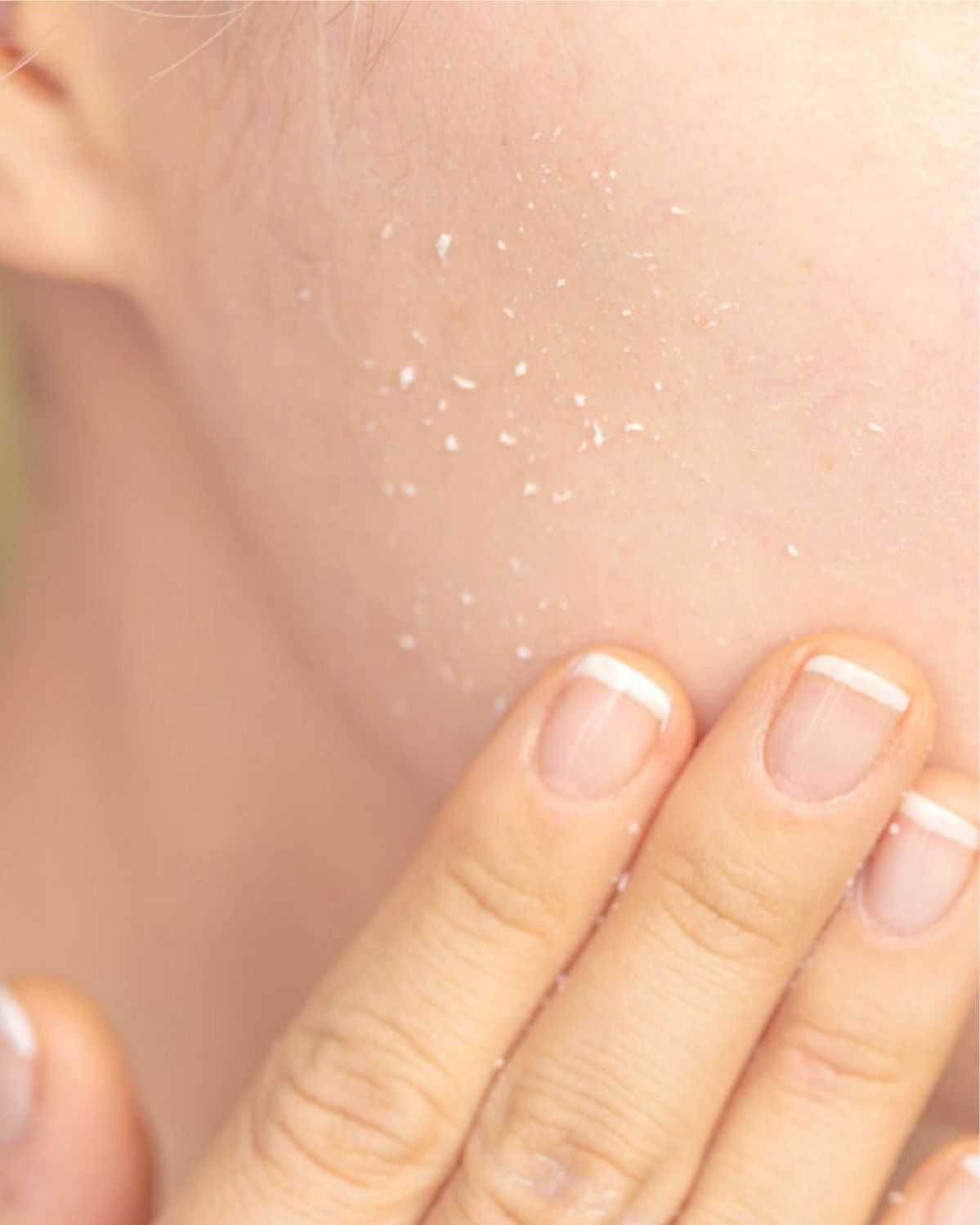 Lactic Acid Bekerja Tanpa Banyak Drama untuk Kulit Glowing